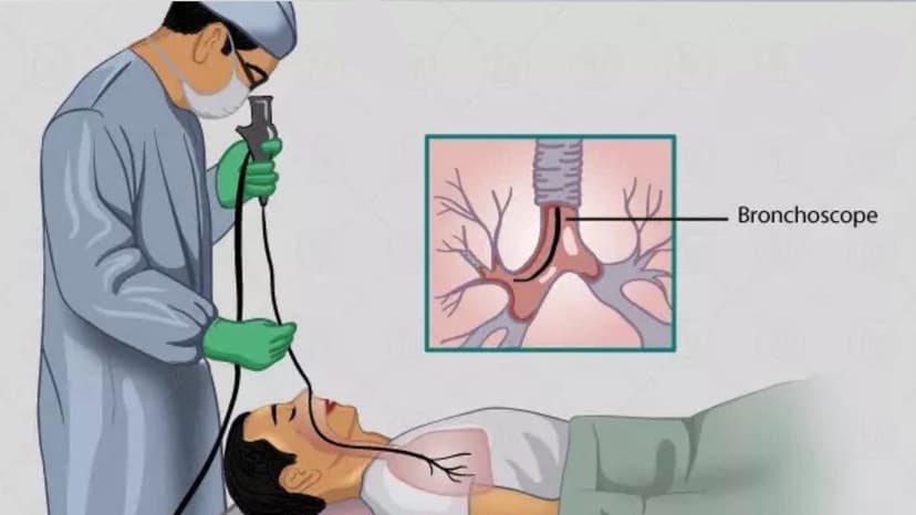 Chống chỉ định nội soi phế quản