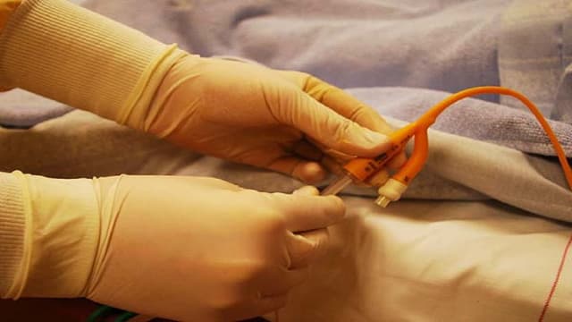 Chỉ định và chống chỉ định rửa bàng quang