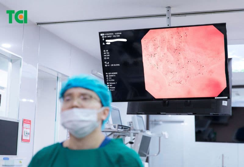 viêm teo niêm mạc dạ dày kèm chuyển sản ruột