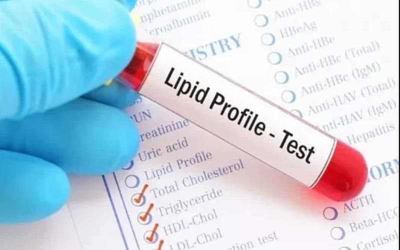 bị mỡ máu có uống dầu cá được không