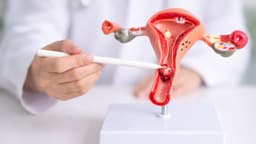 Dấu hiệu ung thư cổ tử cung giai đoạn 4 là gì?