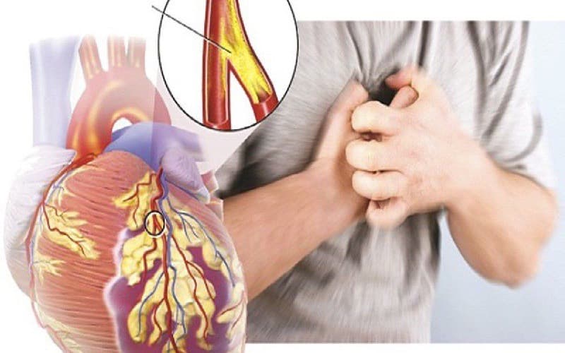 triệu chứng men tim cao