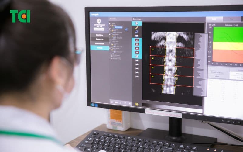 dấu hiệu loãng xương ở người trẻ