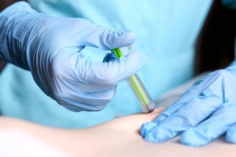 dấu hiệu loãng xương sớm