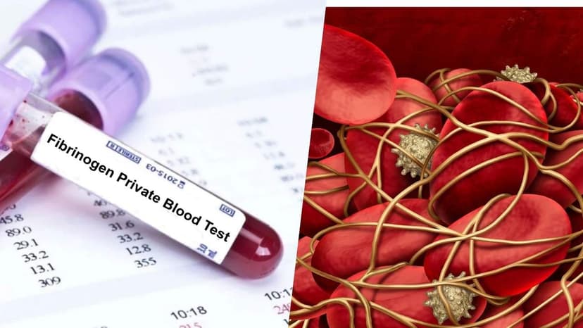 Định lượng Fibrinogen là gì? Giải đáp khi đi khám ngừa đột quỵ