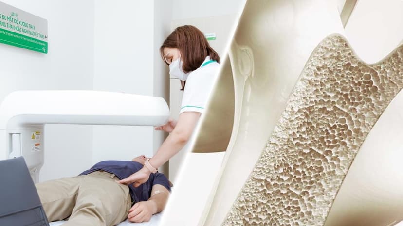 Các chỉ số loãng xương cần biết