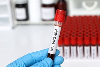 Cách đo tải lượng virus viêm gan B