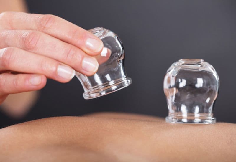 giác hơi có đau không