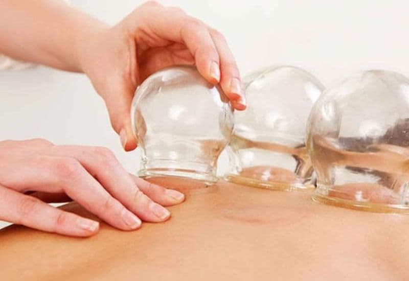 giác hơi cổ vai gáy