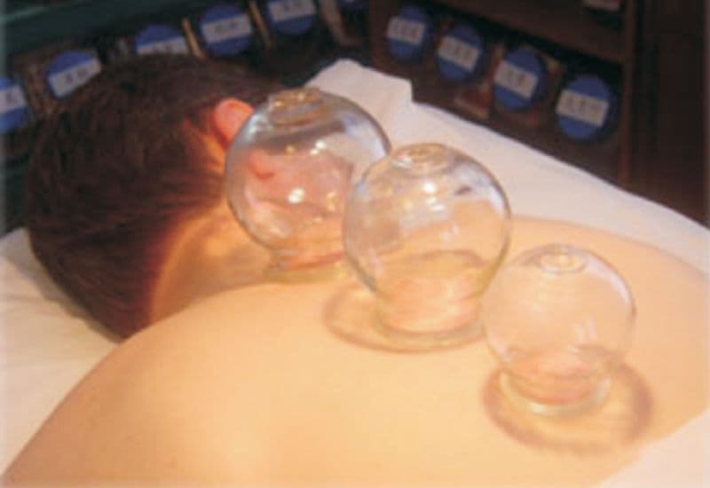 giác hơi cổ vai gáy