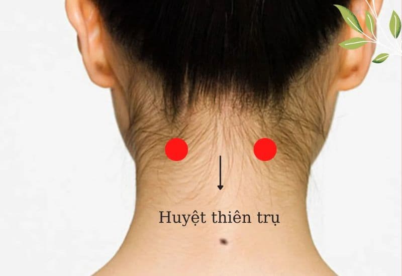 giác hơi giảm đau vai gáy