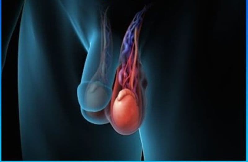 giãn tĩnh mạch thừng tinh gây rối loạn cương dương