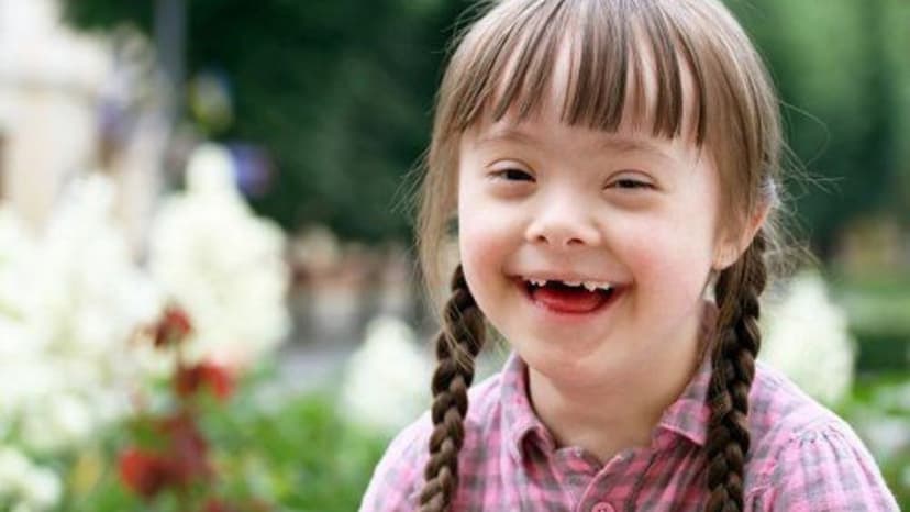 Mẹ bầu cần biết gì về hội chứng Down ở thai nhi?