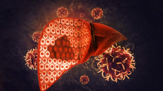 Hội chứng tổn thương tế bào gan