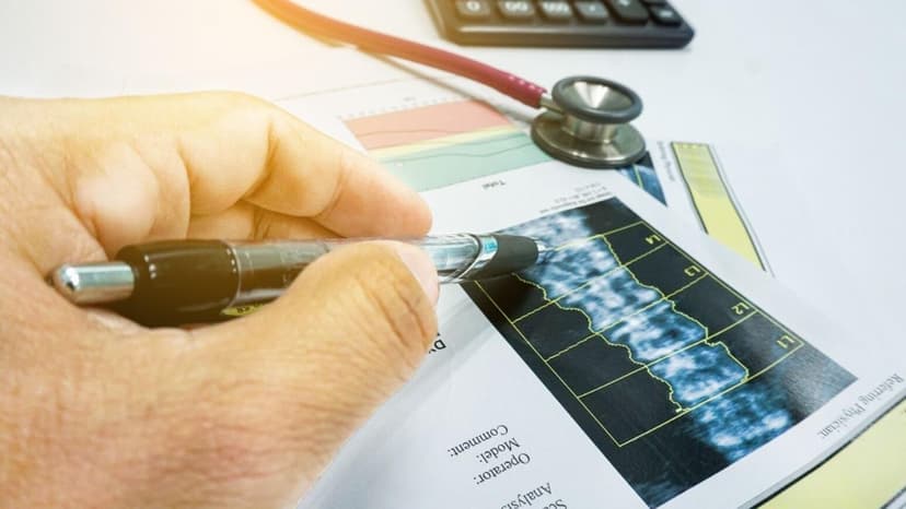 Khi nào cần đo loãng xương?