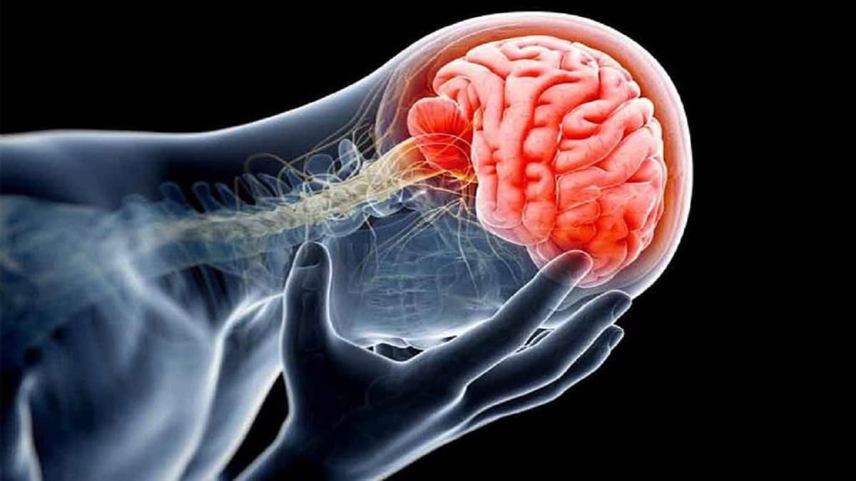 Di chứng liệt nửa người do nhồi máu não