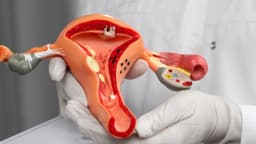 Mổ u xơ tử cung có biến chứng gì không?