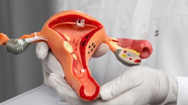 Mổ u xơ tử cung có biến chứng gì không?