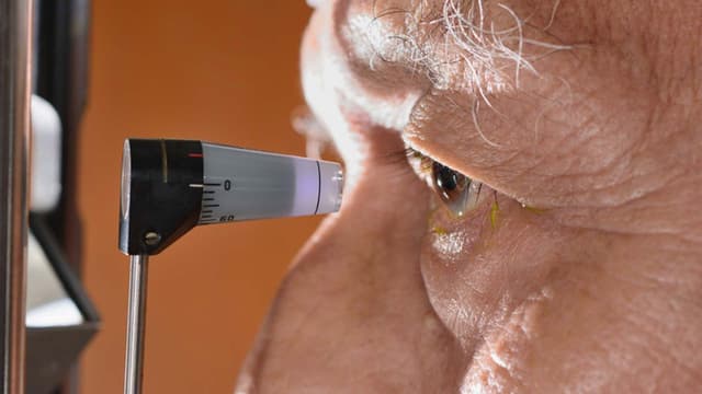 Nhãn áp thấp có nguy hiểm không?