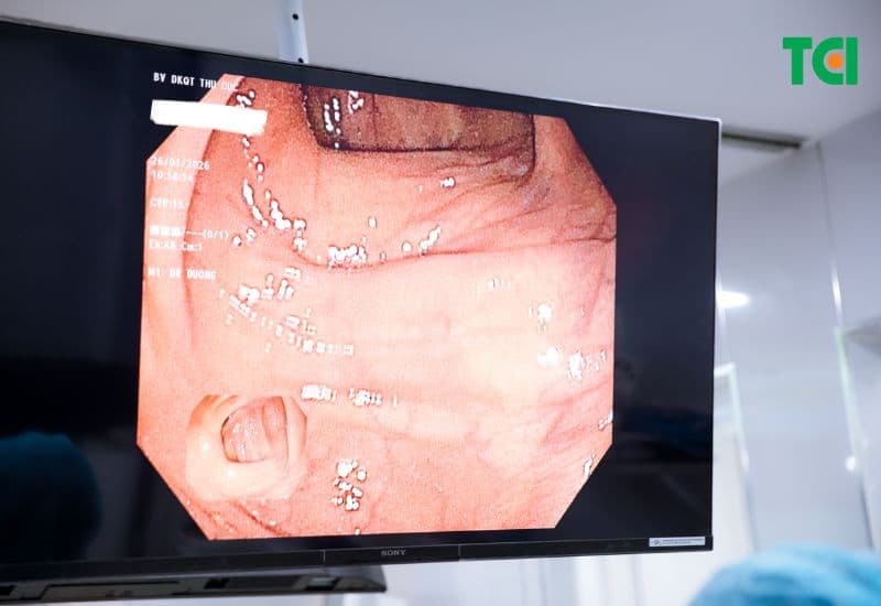 nội soi tiêu hóa phát hiện ung thư không