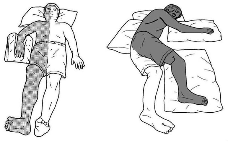 dấu hiệu có cục máu đông trong não