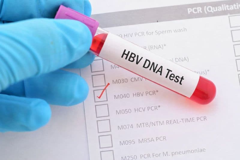 tải lượng virus viêm gan b cao