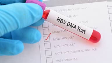 Tải lượng virus viêm gan B bao nhiêu là cao?