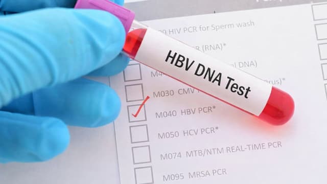 Tải lượng virus viêm gan B bao nhiêu là cao?