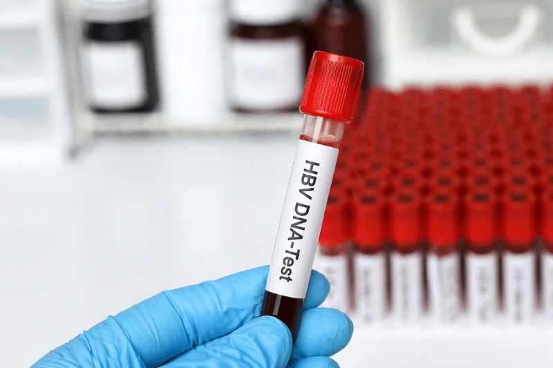 đo tải lượng virus viêm gan B