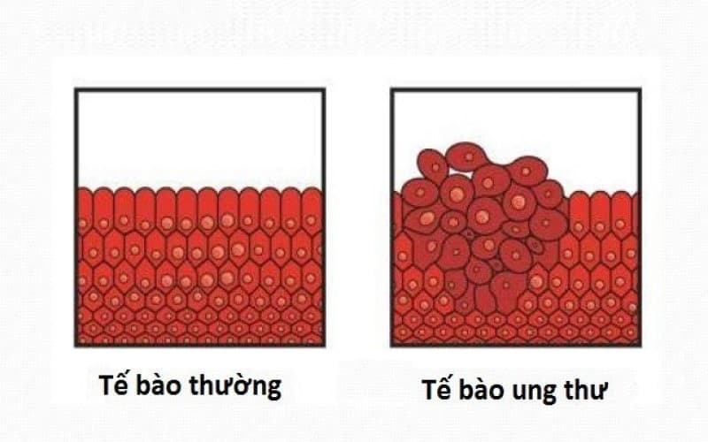 so sánh tế bào thường và tế bào ung thư