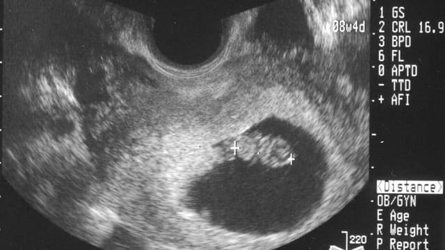 Thai 8 tuần chiều dài đầu mông bao nhiêu?