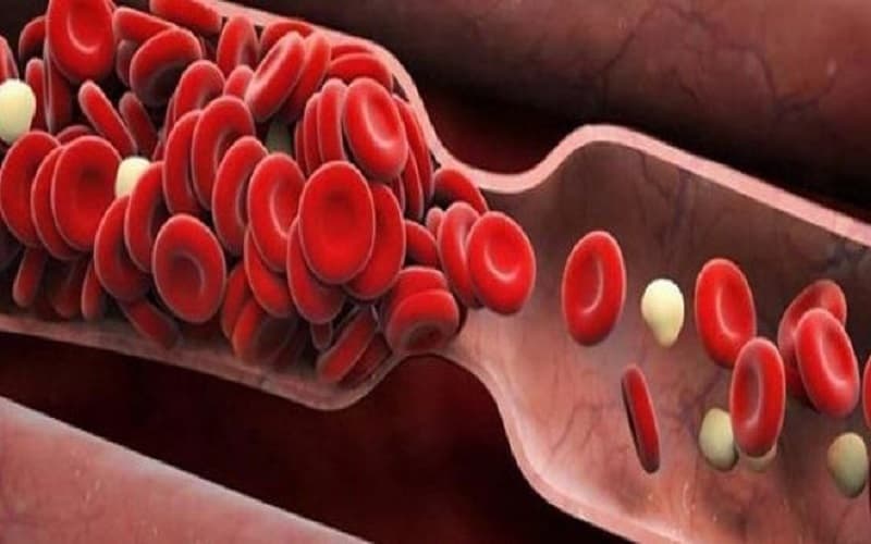 chỉ định tiêu sợi huyết trong nhồi máu não