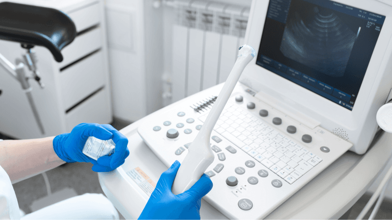 u nang buồng trứng siêu âm có thấy không