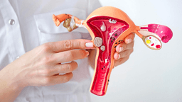 U xơ tử cung có phải mổ không?