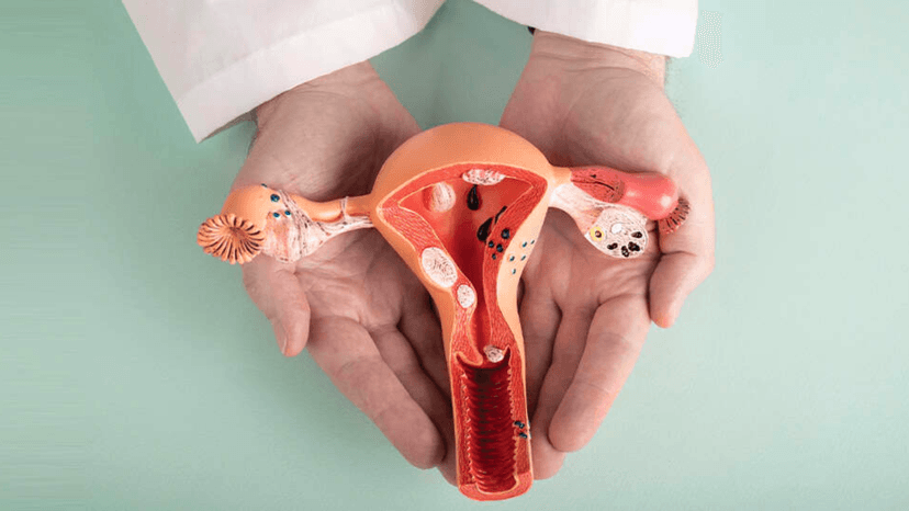 U xơ tử cung gây chảy máu có nguy hiểm?