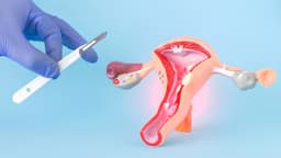 U xơ tử cung sau mãn kinh có đáng lo?