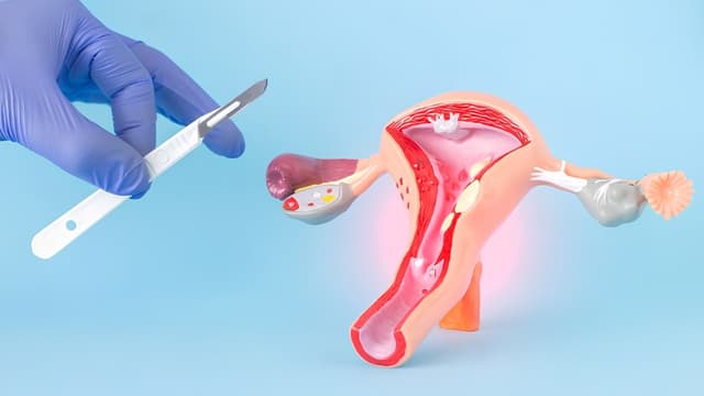 U xơ tử cung sau mãn kinh có đáng lo?