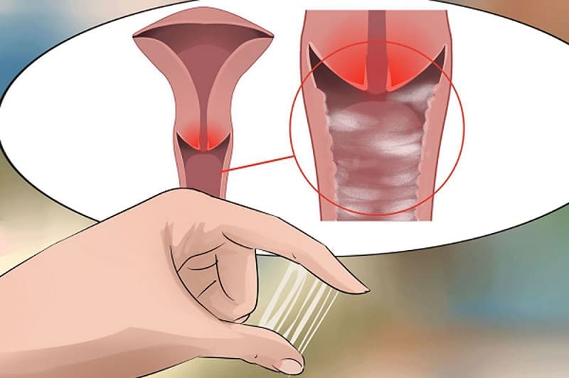 ung thư cổ tử cung có kinh nguyệt không