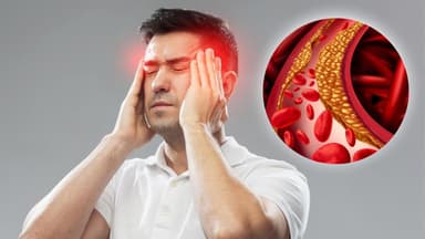 Các xét nghiệm xơ vữa mạch máu cần làm để giảm nguy cơ đột quỵ