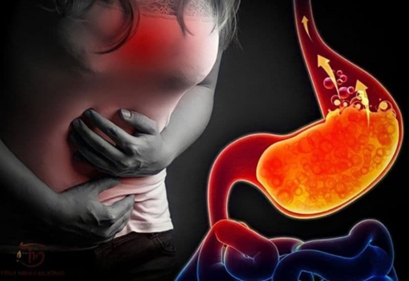 nội soi tiêu hóa giúp phát hiện bệnh gì