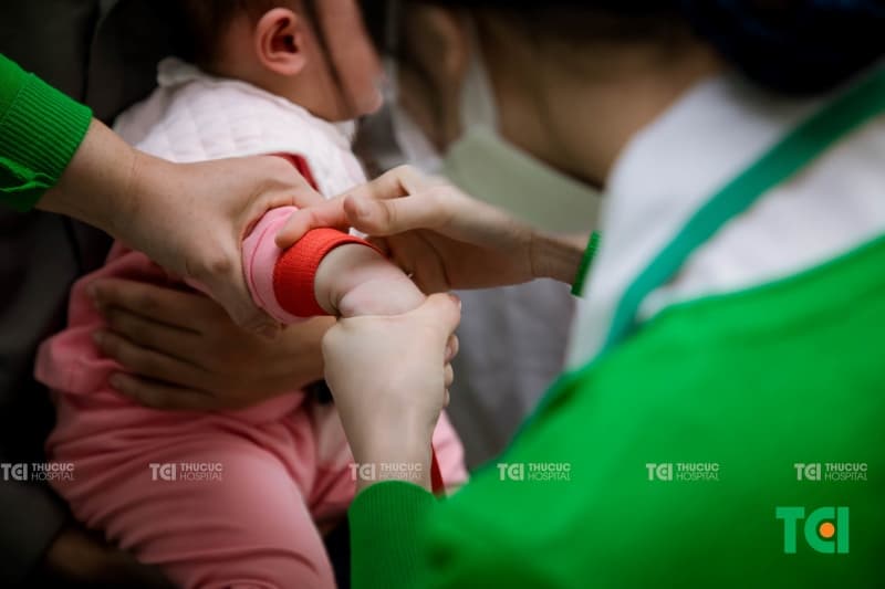 áp xe tuyến giáp ở trẻ em
