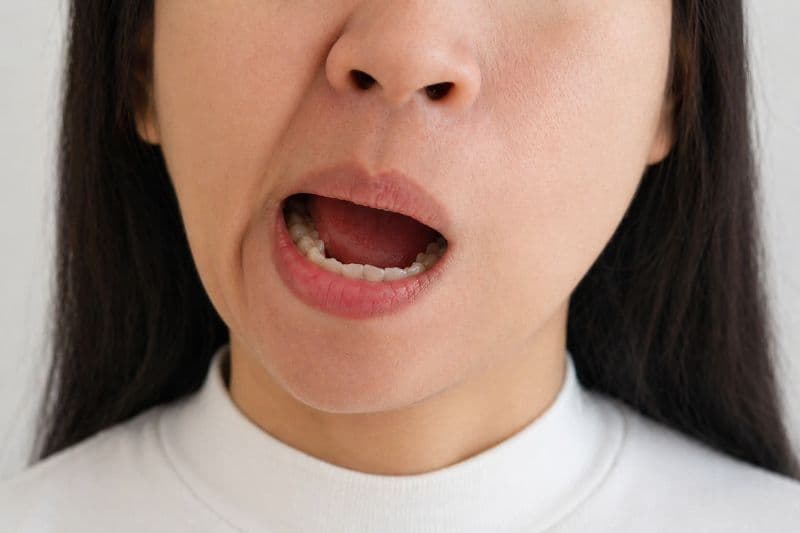 bài test nguy cơ đột quỵ