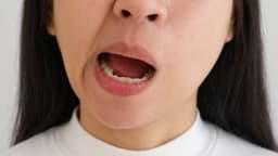 Các bài test nguy cơ đột quỵ
