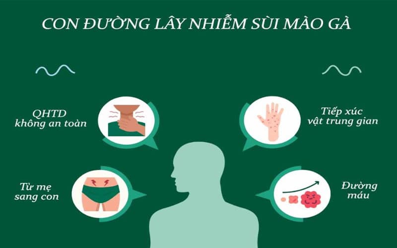 bệnh sùi mào gà bao lâu phát bệnh
