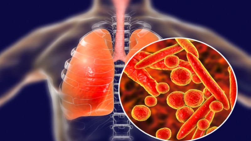 khả năng gây bệnh của vi khuẩn lao