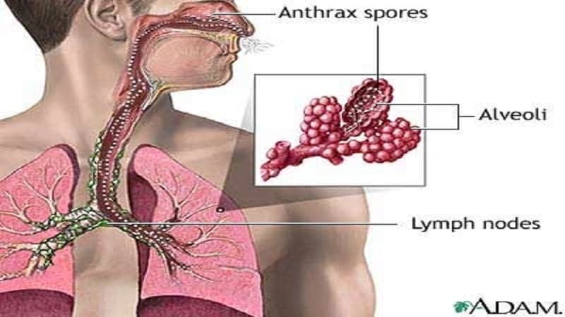 bệnh than do virus hay vi khuẩn gây ra