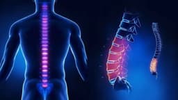 Bị đau lưng dưới gần mông ở nam giới, vì sao?