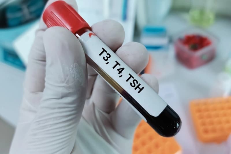 xét nghiệm chức năng tuyến giáp là gì