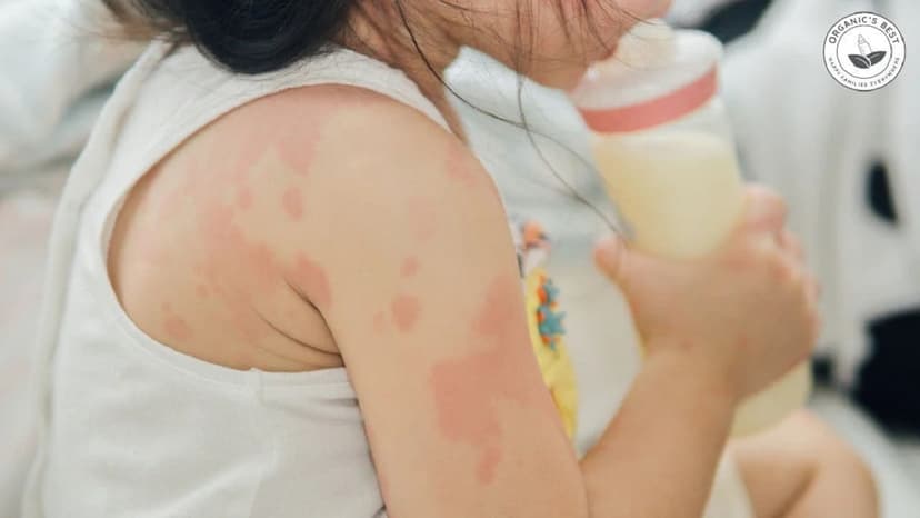 Cách thử sữa cho trẻ dị ứng đạm bò