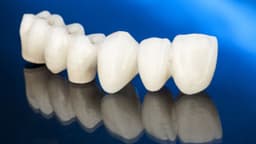 Hướng dẫn cách vệ sinh cầu răng sứ